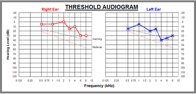 audiogram_age.gif