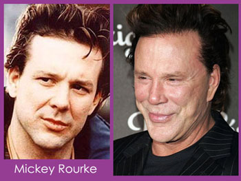 mickey-rourke-plastic-surgery.jpg