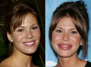 nikki cox before and after plastic surgery photos OMG WTF Did You Do to Your Face! Celebrity ...jpeg